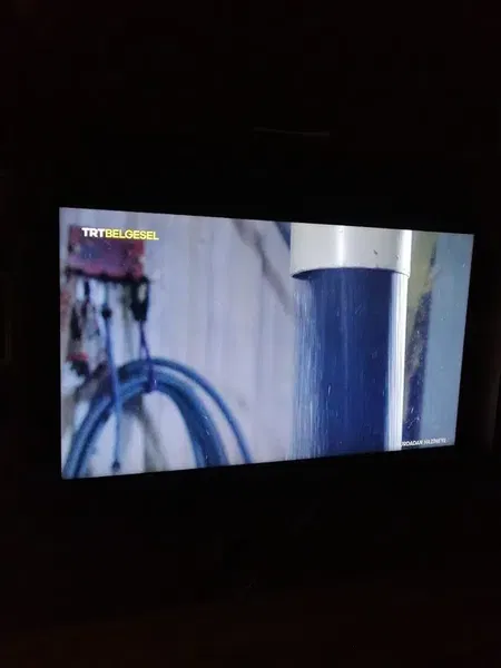 Antalya Televizyon Hastanesi - Photo 9