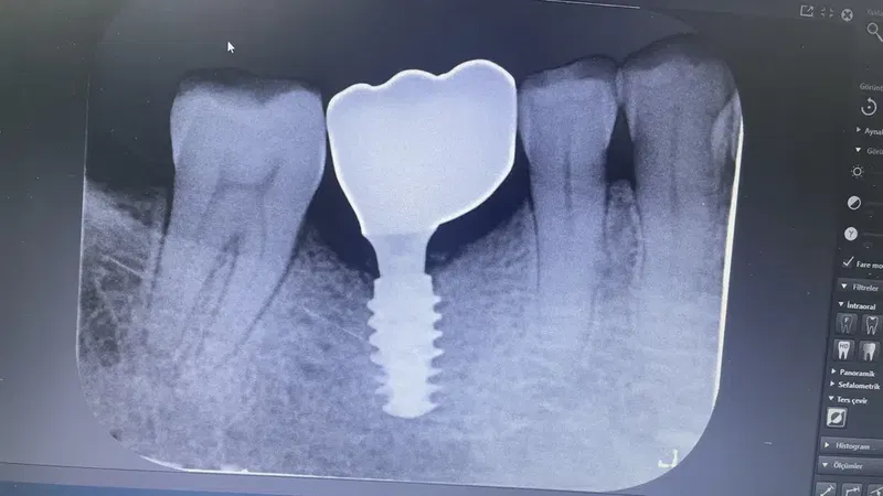 Diş Hekimi, Uzman Diş Hekimi Yusuf Şamil Doymuş, Protez Uzmanı, Prosthodontist, Протезист, İmplant, Gülüş Tasarımı - Photo 1