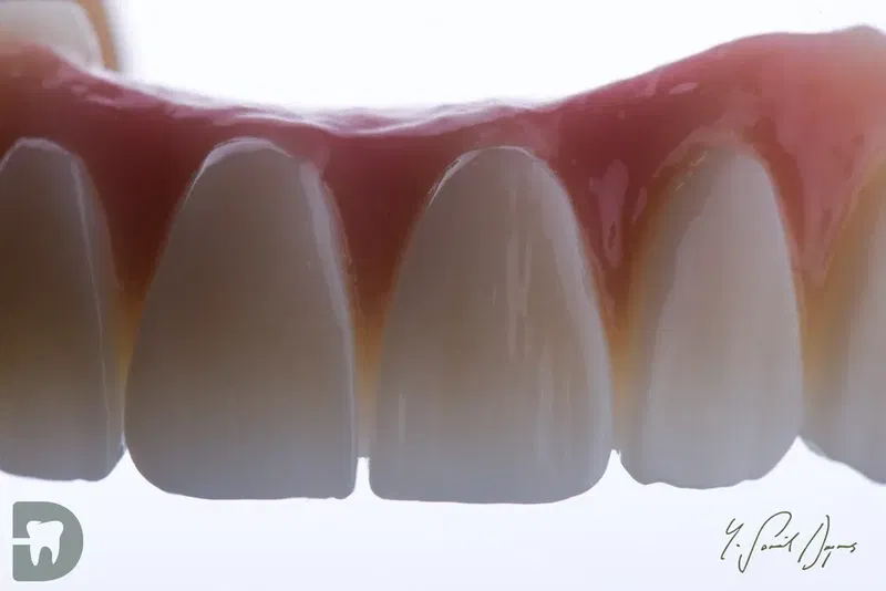 Diş Hekimi, Uzman Diş Hekimi Yusuf Şamil Doymuş, Protez Uzmanı, Prosthodontist, Протезист, İmplant, Gülüş Tasarımı - Photo 2