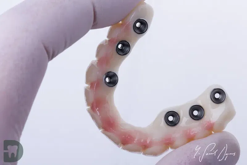Diş Hekimi, Uzman Diş Hekimi Yusuf Şamil Doymuş, Protez Uzmanı, Prosthodontist, Протезист, İmplant, Gülüş Tasarımı - Photo 5