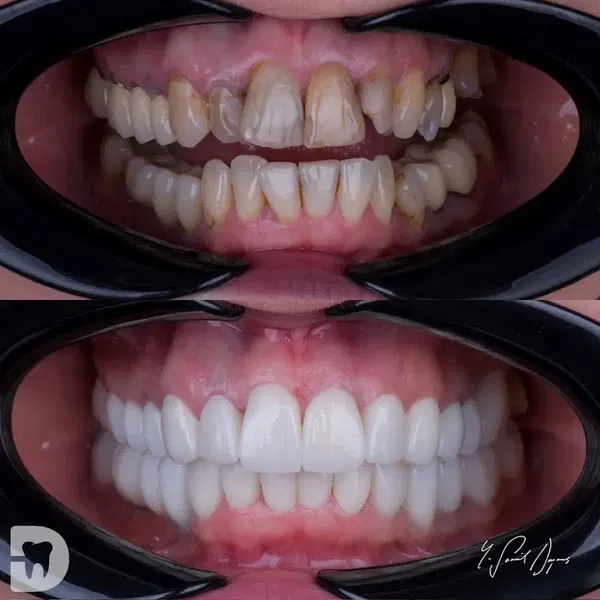 Diş Hekimi, Uzman Diş Hekimi Yusuf Şamil Doymuş, Protez Uzmanı, Prosthodontist, Протезист, İmplant, Gülüş Tasarımı - Photo 6