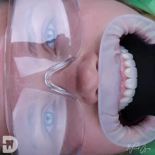 Diş Hekimi, Uzman Diş Hekimi Yusuf Şamil Doymuş, Protez Uzmanı, Prosthodontist, Протезист, İmplant, Gülüş Tasarımı - Photo 9