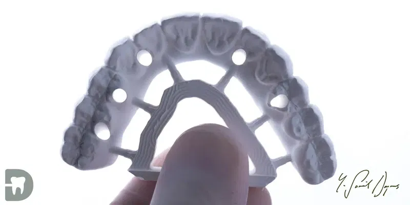 Diş Hekimi, Uzman Diş Hekimi Yusuf Şamil Doymuş, Protez Uzmanı, Prosthodontist, Протезист, İmplant, Gülüş Tasarımı - Photo 10