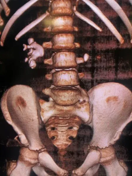 Doç. Dr. Murat UÇAR Çocuk Ürolojisi - Photo 2