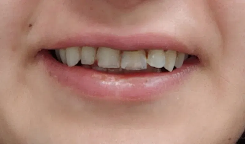 Elitia Dental Studio Turkey - Photo 4