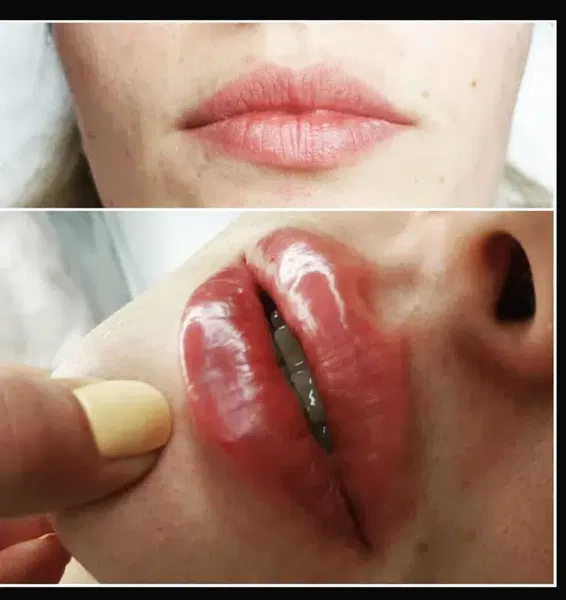 Op.Dr.Onur Serin Estetik, Plastik Cerrahi Uzmanı - Photo 9