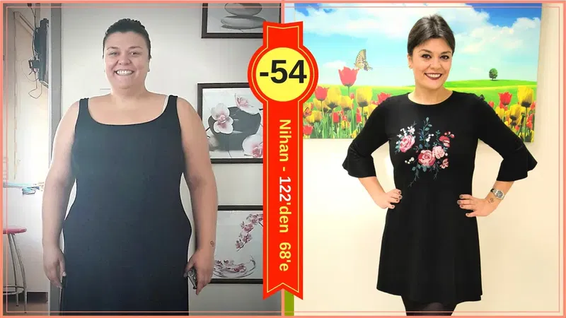 Prof. Dr. Mehmet GÜLER - Obezite ve Metabolik Cerrahi - Gastric Sleeve & Gastric Bypass - Photo 6
