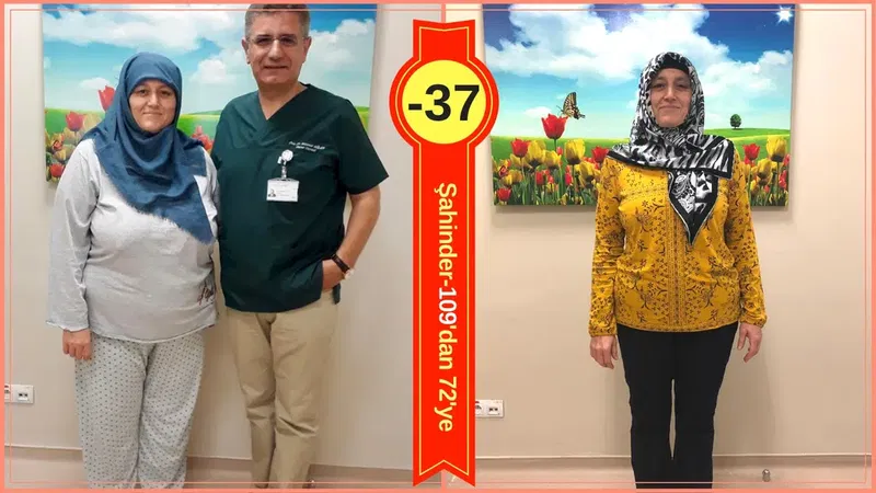 Prof. Dr. Mehmet GÜLER - Obezite ve Metabolik Cerrahi - Gastric Sleeve & Gastric Bypass - Photo 9