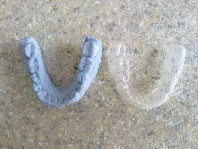 Ultradent Antalya - Photo 10